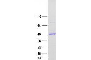 Western Blotting (WB) image for neonatal Fc Receptor (FcRn) (Transcript Variant 2) protein (Myc-DYKDDDDK Tag) (ABIN2720990)