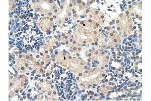 C14ORF130 antibody was used for immunohistochemistry at a concentration of 4-8 ug/ml to stain Epithelial cells of renal tubule (arrows) in Human Kidney. (UBR7 Antikörper  (Middle Region))