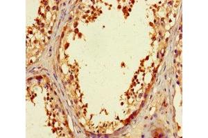 Immunohistochemistry of paraffin-embedded human testis tissue using ABIN7176179 at dilution of 1:100 (ZNF23 Antikörper  (AA 201-474))
