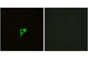 Immunofluorescence analysis of LOVO cells, using CHRM2 Antibody. (Muscarinic Acetylcholine Receptor M2 Antikörper  (AA 185-234))