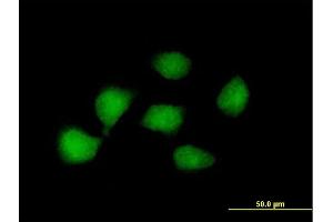Immunofluorescence of purified MaxPab antibody to KLF8 on HeLa cell. (KLF8 Antikörper  (AA 1-359))