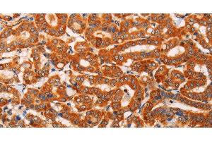 Immunohistochemistry (Paraffin-embedded Sections) (IHC (p)) image for anti-Solute Carrier Family 25 (Mitochondrial Carrier, Adenine Nucleotide Translocator), Member 4 (SLC25A4) antibody (ABIN7238504)