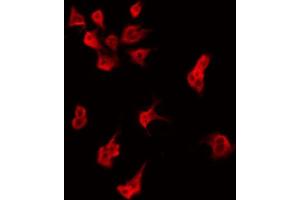 ABIN6274848 staining HeLa by IF/ICC. (AIG1 Antikörper  (C-Term))