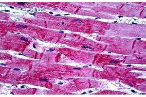 Human Heart: Formalin-Fixed, Paraffin-Embedded (FFPE) (HSPB8 Antikörper  (AA 97-197))