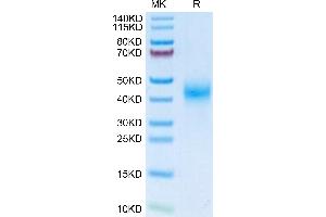 Fc gamma RII (CD32) (AA 32-215) protein (His tag)