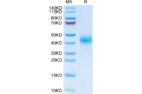 Fc gamma RII (CD32) (AA 32-215) protein (His tag)