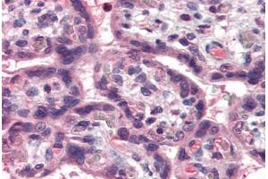 Immunohistochemistry (Paraffin-embedded Sections) (IHC (p)) image for anti-Tumor Necrosis Factor (Ligand) Superfamily, Member 15 (TNFSF15) (N-Term) antibody (ABIN337133)