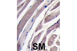 Formalin-fixed and paraffin-embedded human skeletal muscle tissue reacted with HK2 polyclonal antibody  , which was peroxidase-conjugated to the secondary antibody, followed by DAB staining. (Hexokinase 2 Antikörper  (N-Term))