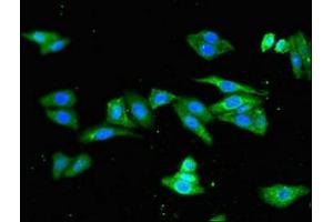 Immunofluorescent analysis of HepG2 cells using ABIN7163820 at dilution of 1:100 and Alexa Fluor 488-congugated AffiniPure Goat Anti-Rabbit IgG(H+L) (PKD1L1 Antikörper  (AA 921-1164))