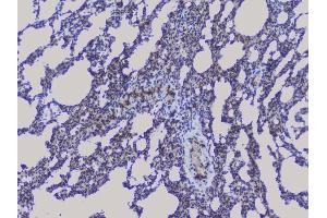 IHC analysis of NRF1 using anti-NRF1 antibody (ABIN6719347). (NRF1 Antikörper  (AA 246-503))