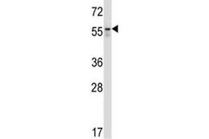 BECN antibody western blot analysis in Jurkat lysate (Beclin 1 Antikörper  (AA 52-78))