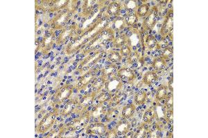 Immunohistochemistry of paraffin-embedded mouse kidney using CCNA2 antibody at dilution of 1:100 (x400 lens). (Cyclin A Antikörper)