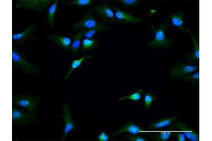 Immunofluorescence of purified MaxPab antibody to RAPGEF3 on HeLa cell. (RAPGEF3 Antikörper  (AA 1-881))