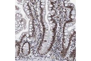 Immunohistochemical staining of human small intestine with EFTUD2 polyclonal antibody  strong cytoplasmic positivity in glandular cells at 1:200-1:500 dilution. (EFTUD2 Antikörper)