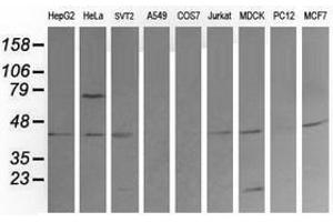 Image no. 6 for anti-Mitogen-Activated Protein Kinase Kinase 1 (MAP2K1) antibody (ABIN1499391) (MEK1 Antikörper)