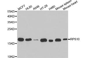 Western blot analysis of extracts of various cell lines, using RPS10 antibody (ABIN5973486) at 1/1000 dilution. (RPS10 Antikörper)