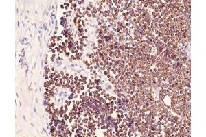 Immunohistochemistry (IHC) image for anti-Keratin 20 (KRT20) (C-Term) antibody (ABIN870619) (KRT20 Antikörper  (C-Term))