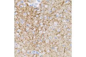 Immunohistochemistry of paraffin-embedded mouse brain using NTF3 antibody (ABIN6290617) (40x lens).