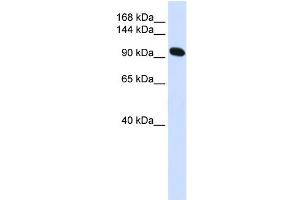 WB Suggested Anti-ACTN2 Antibody Titration:  0.