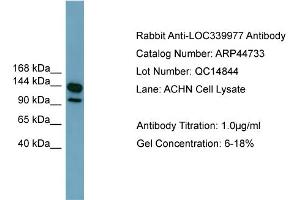 WB Suggested Anti-LRRC66  Antibody Titration: 0. (LRRC66 Antikörper  (Middle Region))