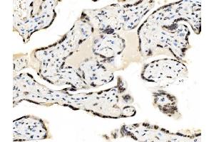 IHC analysis of JUNB using anti-JUNB antibody (ABIN7603223). (JunB Antikörper  (N-Term))