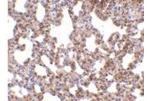 Immunohistochemistry of TRPC6 in mouse lung tissue with this product at 10 μg/ml. (TRPC6 Antikörper  (C-Term))