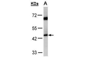 WB Image Sample(30 μg of whole cell lysate) A:HeLa S3, 10% SDS PAGE antibody diluted at 1:1000 (Medium-Chain Specific Acyl-CoA Dehydrogenase, Mitochondrial (C-Term) Antikörper)