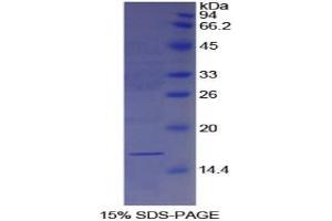 SDS-PAGE analysis of Human Galectin 7 Protein. (LGALS7 Protein)