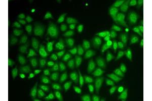 Immunofluorescence analysis of HeLa cells using AKR1A1 antibody. (AKR1A1 Antikörper  (AA 1-325))