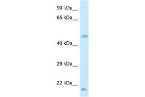 WB Suggested Anti-LOC100360413 Antibody   Titration: 1. (LOC100360413 Antikörper  (Middle Region))