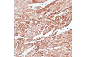 Immunohistochemistry of paraffin-embedded mouse heart using TMX1 antibody  at dilution of 1:100 (40x lens). (TMX1 Antikörper  (AA 210-280))