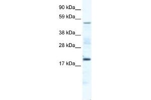 WB Suggested Anti-CSNK1G1 Antibody Titration:  5.