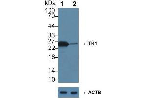 Knockout Varification: ;Lane 1: Wild-type MCF7 cell lysate; ;Lane 2: TK1 knockout MCF7 cell lysate; ;Predicted MW: 25kDa ;Observed MW: 25kDa;Primary Ab: 6µg/ml Mouse Anti-Human TK1 Antibody;Second Ab: 0.