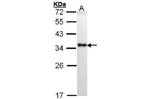 WB Image Sample (30 ug of whole cell lysate) A: H1299 12% SDS PAGE antibody diluted at 1:1000 (HLA-DRA Antikörper)