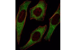 Immunofluorescence (IF) image for anti-Insulin Receptor Substrate 2 (IRS2) antibody (ABIN3003492) (IRS2 Antikörper)