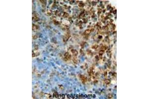 Immunohistochemistry (IHC) image for anti-Inosine Triphosphatase (ITPA) antibody (ABIN3002176) (ITPA Antikörper)