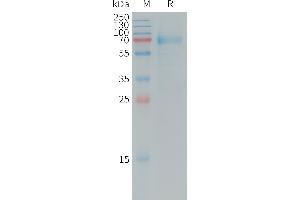 Interleukin 20 Receptor alpha (IL20RA) (AA 30-250) protein (Fc Tag)