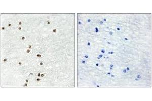 Immunohistochemistry analysis of paraffin-embedded human brain tissue, using ZIC1/2/3 Antibody. (ZIC1/2/3 Antikörper  (AA 316-365))