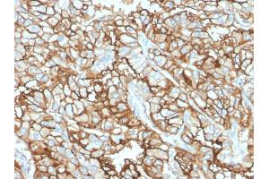 Immunohistochemistry (IHC) image for anti-Membrane Metallo-Endopeptidase (MME) (AA 297-483) antibody (ABIN6940058)