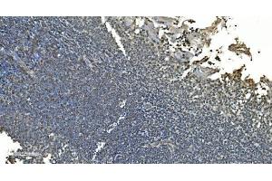 IHC analysis of LSM8 using anti-LSM8 antibody (ABIN7599579). (NAA38 Antikörper  (AA 1-96))