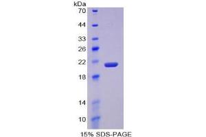 SDS-PAGE analysis of Mouse MMP12 Protein.