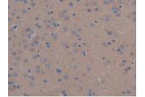 IHC-P analysis of Mouse Liver Tissue, with DAB staining. (MAP6 Antikörper  (AA 177-387))