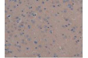 IHC-P analysis of Mouse Liver Tissue, with DAB staining. (MAP6 Antikörper  (AA 177-387))