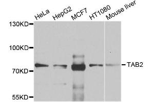Western blot analysis of extracts of various cell lines, using TAB2 antibody (ABIN6003599) at 1/1000 dilution. (TAB2 Antikörper)