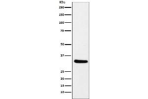 Western blot analysis of CRALBP expression in mouse eyeball lysate.