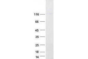 Validation with Western Blot (ATP6V0A1 Protein (Transcript Variant 3) (Myc-DYKDDDDK Tag))