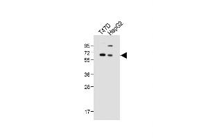 Western Blotting (WB) image for anti-serpin Peptidase Inhibitor, Clade A (Alpha-1 Antiproteinase, Antitrypsin), Member 6 (SERPINA6) (AA 197-225) antibody (ABIN654693)