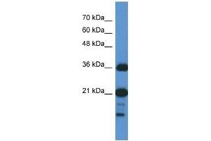 C1orf144 antibody used at 1 ug/ml to detect target protein. (C1orf144 Antikörper  (N-Term))