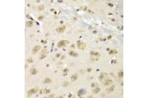 Immunohistochemistry of paraffin-embedded mouse brain using S100A10 antibody at dilution of 1:100 (x40 lens).