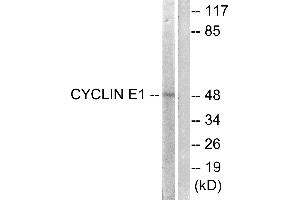 Western blot analysis of extracts from HeLa cells, treated with Paclitasel (1uM, 60mins), using Cyclin(Ab-395) antibody (#B0069, Line 1 and 2). (Cyclin E1 Antikörper  (Thr395))